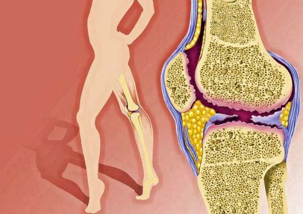 Продукты, которые убивают ваши суставы