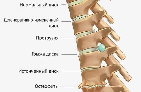 Гимнастика для позвоночника Мирзакарима Норбекова